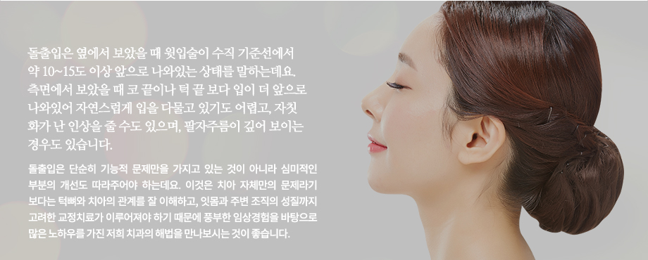 돌출입은 옆에서 보았을 때 윗입술이 수직 기준선에서 약 10~15도 이상 앞으로 나와있는 상태를 말하는데요. 측면에서 보았을 때 코 끝이나 턱 끝 보다 입이 더 앞으로 나와있어 자연스럽게 입을 다물고 있기도 어렵고, 자칫 화가 난 인상을 줄 수도 있으며, 팔자주름이 깊어 보이는 경우도 있습니다. 돌출입은 단순히 기능적 문제만을 가지고 있는 것이 아니라 심미적인 부분의 개선도 따라주어야 하는데요. 이것은 치아 자체만의 문제라기 보다는 턱뼈와 치아의 관계를 잘 이해하고, 잇몸과 주변 조직의 성질까지 고려한 교정치료가 이루어져야 하기 때문에 풍부한 임상경험을 바탕으로 많은 노하우를 가진 저희 치과의 해법을 만나보시는 것이 좋습니다.