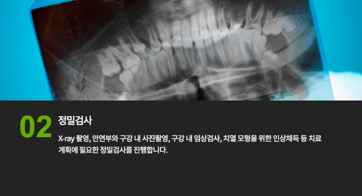 Step 02. 정밀검사
X-ray 촬영, 안면부와 구강 내 사진촬영, 구강 내 임상검사, 치열 모형을 위한 인상채득 등 치료 계획에 필요한 정밀검사를 진행합니다.
