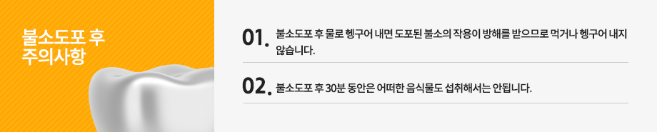 불소도포 후 주의사항
불소도포 후 30분 동안은 어떠한 음식물도 섭취해서는 안됩니다.
불소도포 후 물로 헹구어 내면 도포된 불소의 작용이 방해를 받으므로 먹거나 헹구어 내지 않습니다.