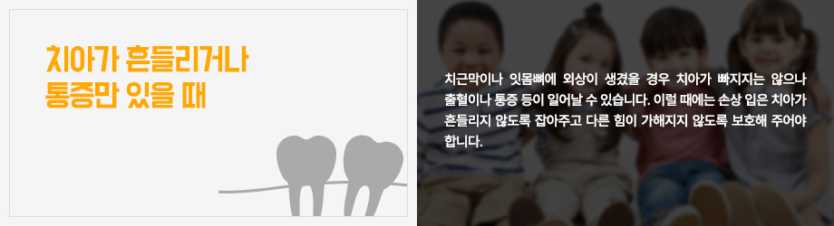 치아가 흔들리거나 통증만 있을 때
치근막이나 잇몸뼈에 외상이 생겼을 경우 치아가 빠지지는 않으나 출혈이나 통증 등이 일어날 수 있습니다. 이럴 때에는 손상 입은 치아가 흔들리지 않도록 잡아주고 다른 힘이 가해지지 않도록 보호해 주어야 합니다. 